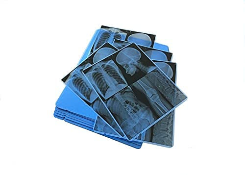 8" X 10" PET Inkjet Blue Medical Imaging Film 210 Micron (280 GSM) Thickness Waterproof (Pack of 100 Sheets)